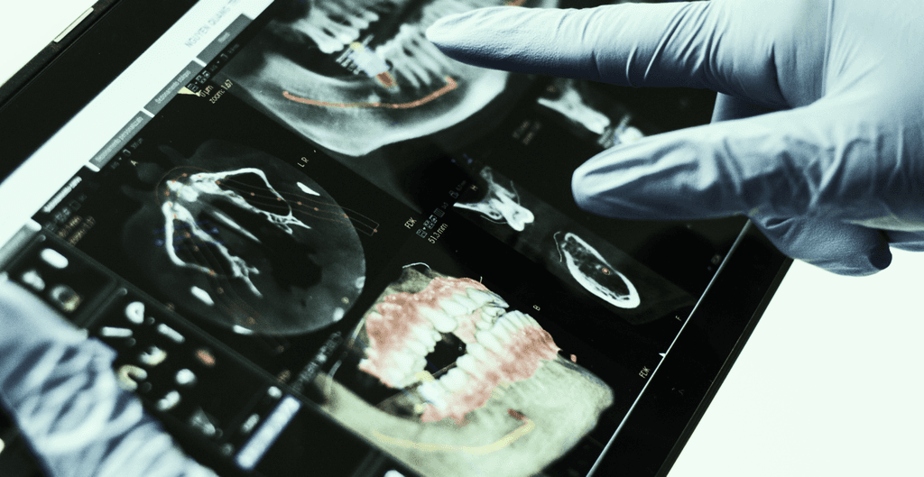 Emergency Dental Care