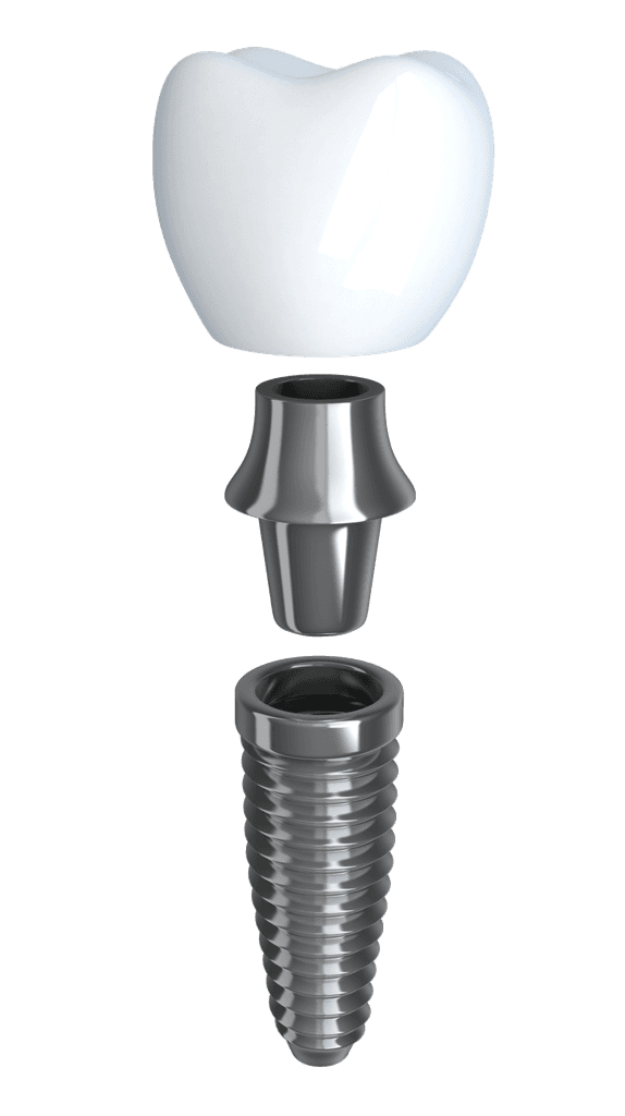 Individual Dental Implants